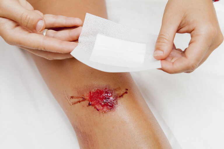 Acute Wound Care